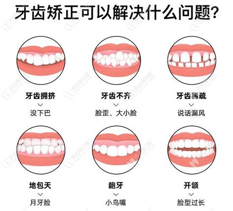 朋友的口腔诊所笑研所，到底是研究什么的？我的牙齿一_圈子-新氧美容整形