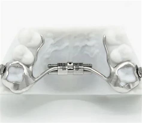 Orthodontic Expander Price at Lois Coffman blog