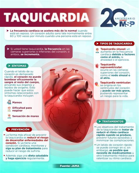 Taquicardia