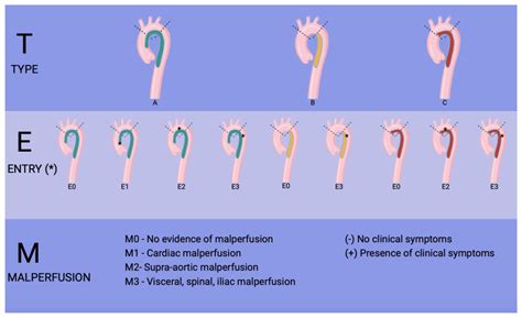 TEM Classification of Aortic Dissection—The Evolving Scoring System: A Literature Review - Heart ...