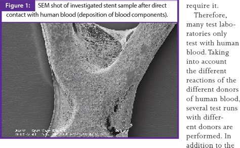 Image result for In Vitro Biocompatibility Test