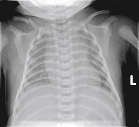 Neonatology - Clinical Tree