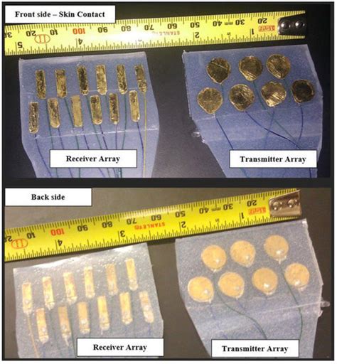 In Situ Investigation of Upper Airway Occlusion in Sleep Disordered ...