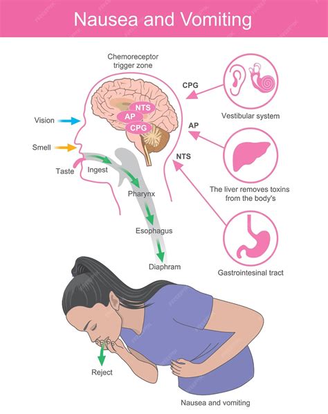 Nausées et vomissements Une femme présentant des symptômes de nausées | Vecteur Premium