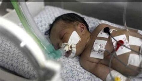 女婴夭折捐肾救人感动网友：中国最小器官捐献者