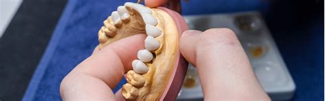 Image result for Different Types Dentures