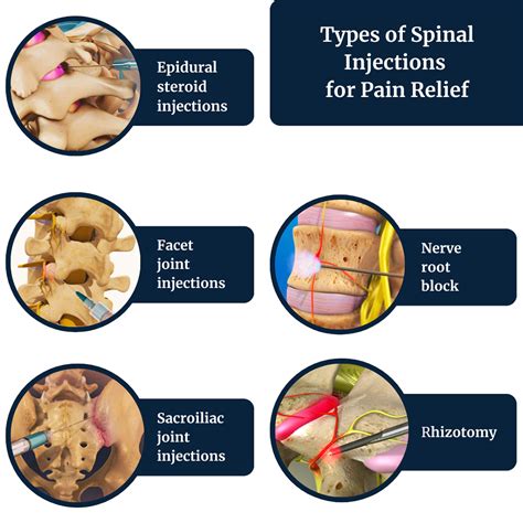 Image result for Paraspinal Injection