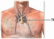 Image result for thymusectomy