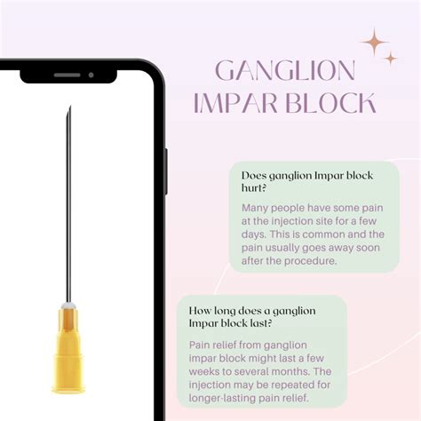 Ganglion Impar Block – South Lake Pain Center – Pain Management ...