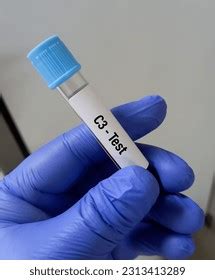 Image result for C4 Complement Blood Test