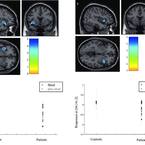 Image result for Visual Snow Simulation