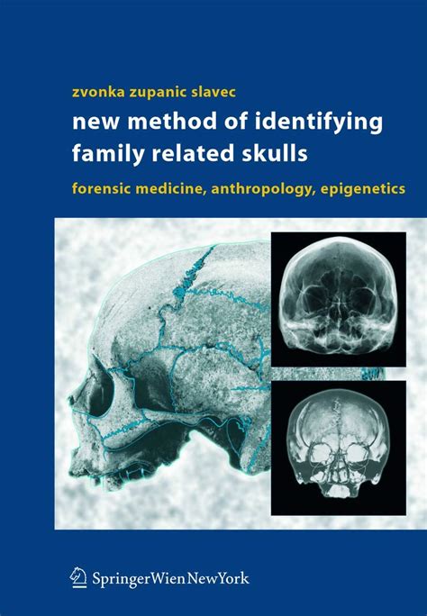 Buy New Method of Identifying Family Related Skulls: Forensic Medicine ...