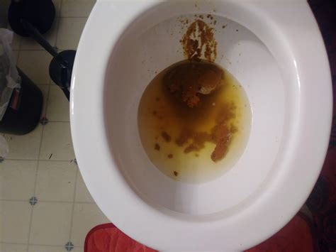 Exploding Poop Human 的图像结果