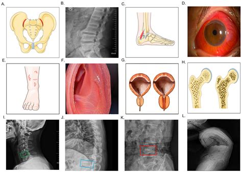 Butyric Acid Modulates Gut Microbiota to Alleviate Inflammation and ...
