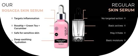 Rosacea Serum to overcome redness, dryness & skin stretching – House Of ...