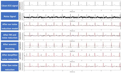 Image result for Frequency Matching Biomedical Device