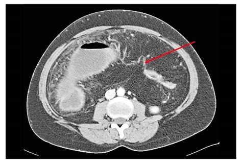 Signos visibles de desgaste en las cuerdas