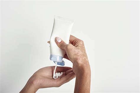 Everything You Need To Know About White Patches On The Face | Femina.in