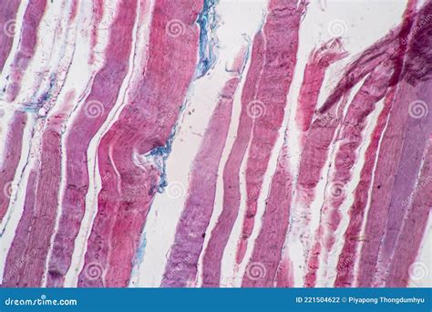 Image result for Skeletal Muscle Tissue Under Microscope
