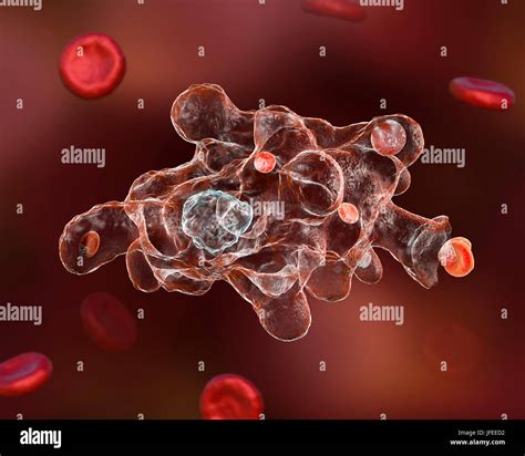 Entamoeba Histolytica Flask Shaped Ulcers