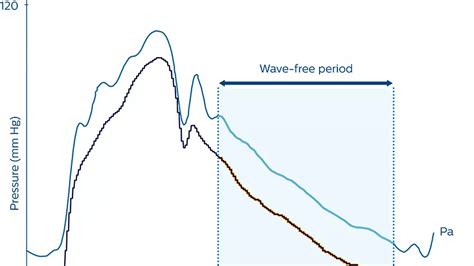 Coronary physiology modalities - Philips