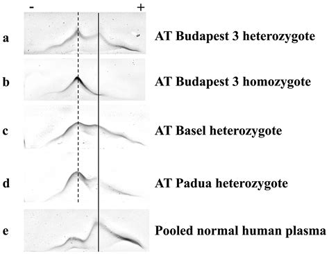 Investigation of the Differences in Antithrombin to Heparin Binding ...