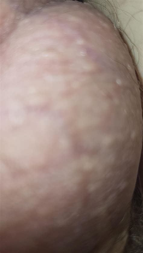 Super HD 1800 60 fps right ball : r/BallStretching