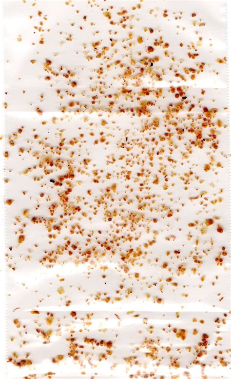 ImageJ Particle Size Distribution Tutorial 的图像结果