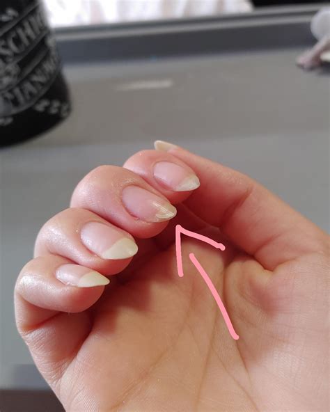 How to Fix Split Nails 的图像结果