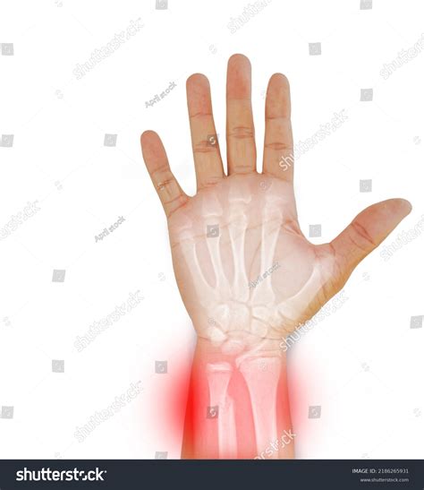 1,413 Proximal Distal Images, Stock Photos & Vectors | Shutterstock