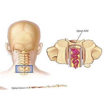 Best neurosurgeon doctor in chembur | Best neurosurgeon doctor in ...