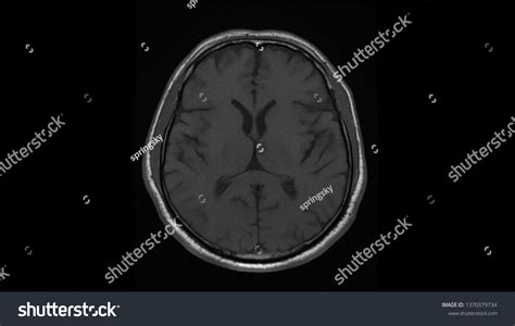 High Res Brain Scan Image 的图像结果