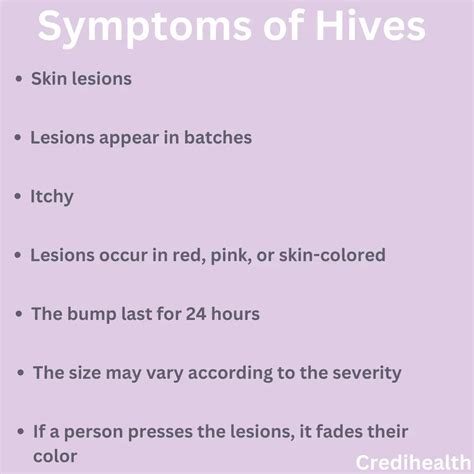 Are Hives Contagious: Types, Symptoms and Treatments | Credihealth