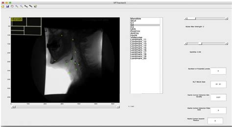 How to Use MATLAB Point Tracker 的图像结果