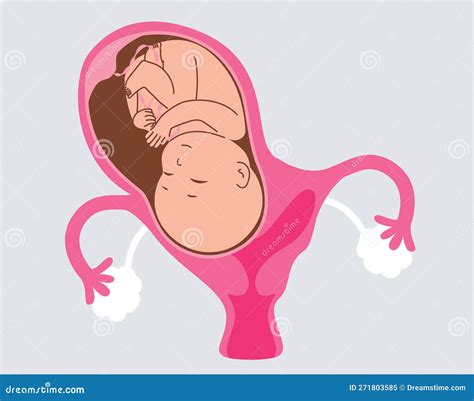 Bicornuate Uterus: What Is It And How Can It Affect Your Pregnancy? – VSZPG