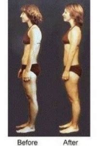 Image result for Structural Integration Exercises