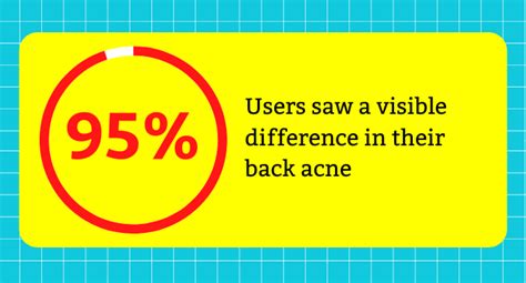 Buy Chemist at Play Acne Control Body Wash with Ceramides | 3% ...