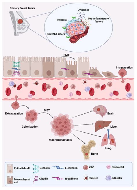 Innovative Approaches to EMT-Related Biomarker Identification in Breast ...
