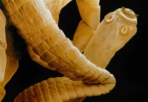 How Big Can Tapeworms Get In Humans? The Yucky Truth