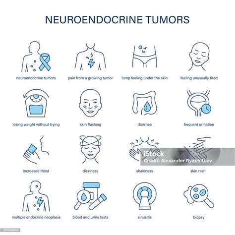 Neuroendocrine Tumors Symptoms Diagnostic And Treatment Vector Icon Set Stock Illustration ...