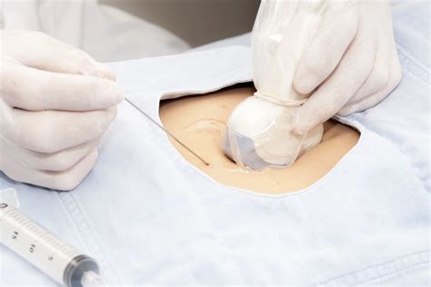 Image result for Fluoro Guided Injection