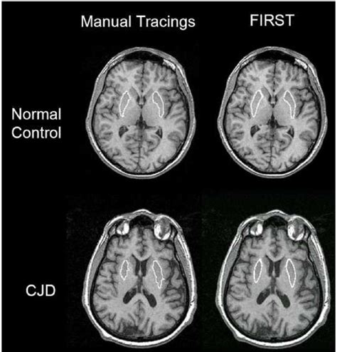 Cth Medical Abbreviation