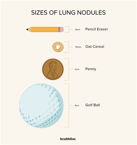 Lung Nodules: Symptoms, Causes, Diagnosis, and Treatment