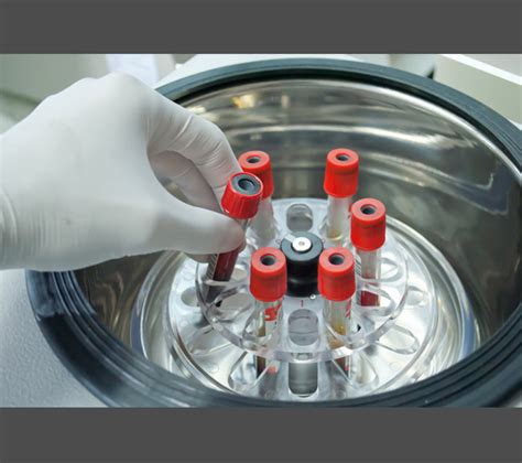 Image result for PRF Testing