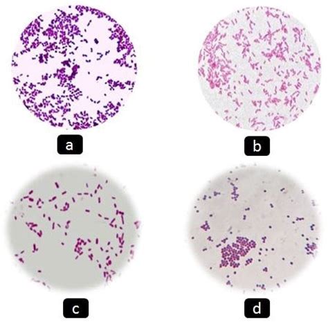 E Faecalis Gram Stain