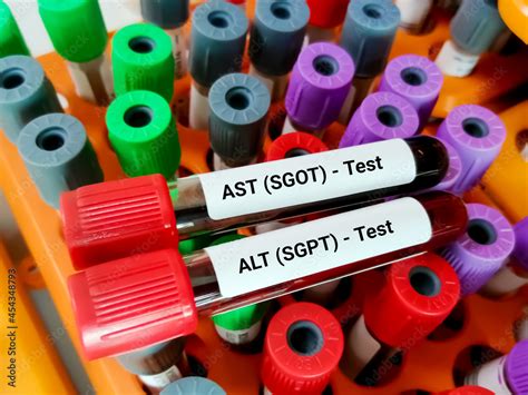 AST Blood Test 的图像结果
