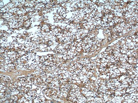 USP46 antibody (13502-1-AP) | Proteintech