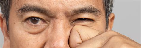 The Seemingly Harmless Eye Twitching Could Signal Something More ...