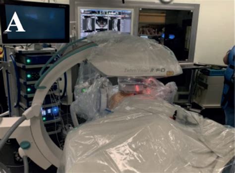 Image result for Fluoroscopy Injection