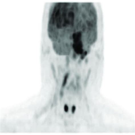 Image result for Open Pet Scan